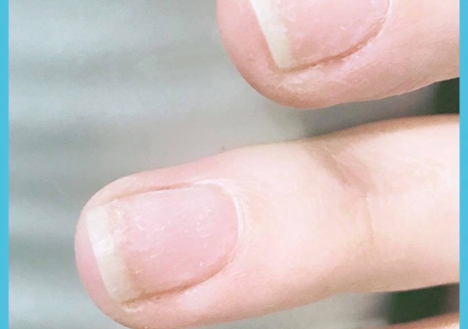 What To Do If You’ve Picked Your Gel Polish Off at Home