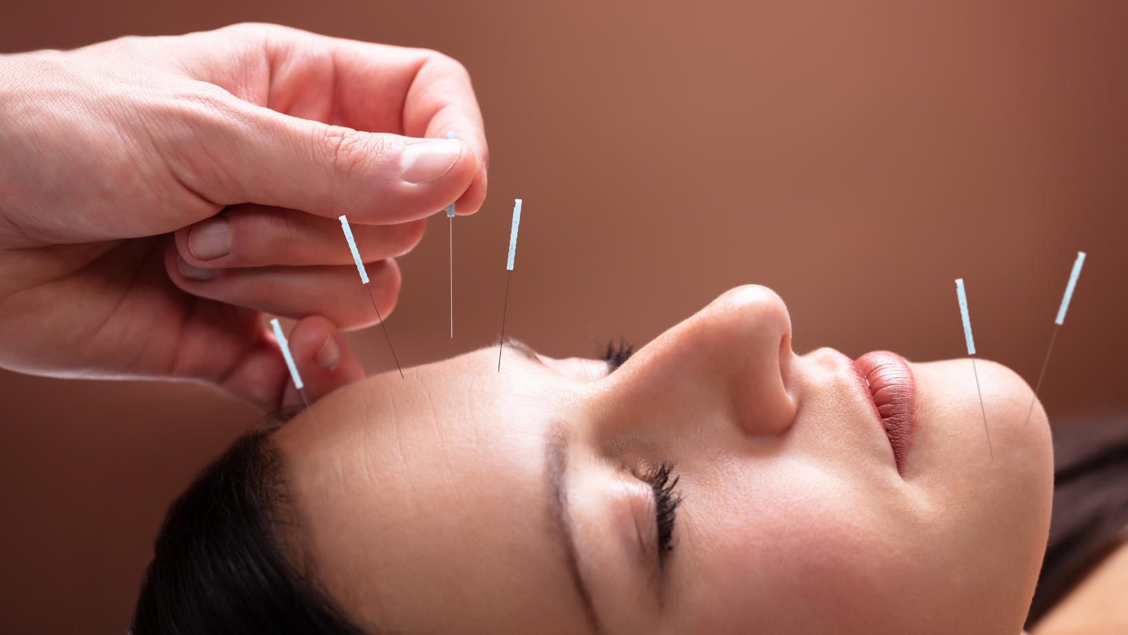 Facial Acupuncutre woman getting facial with acupuncture